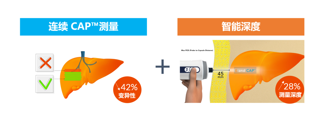 APASL2023 | SmartExam by FibroScan?在NAFLD中的應(yīng)用優(yōu)勢