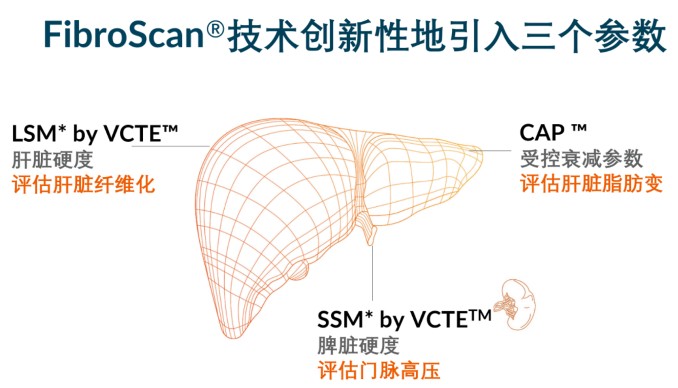 喜訊！FDA擴大了FibroScan?在肝臟綜合管理中的應用范圍