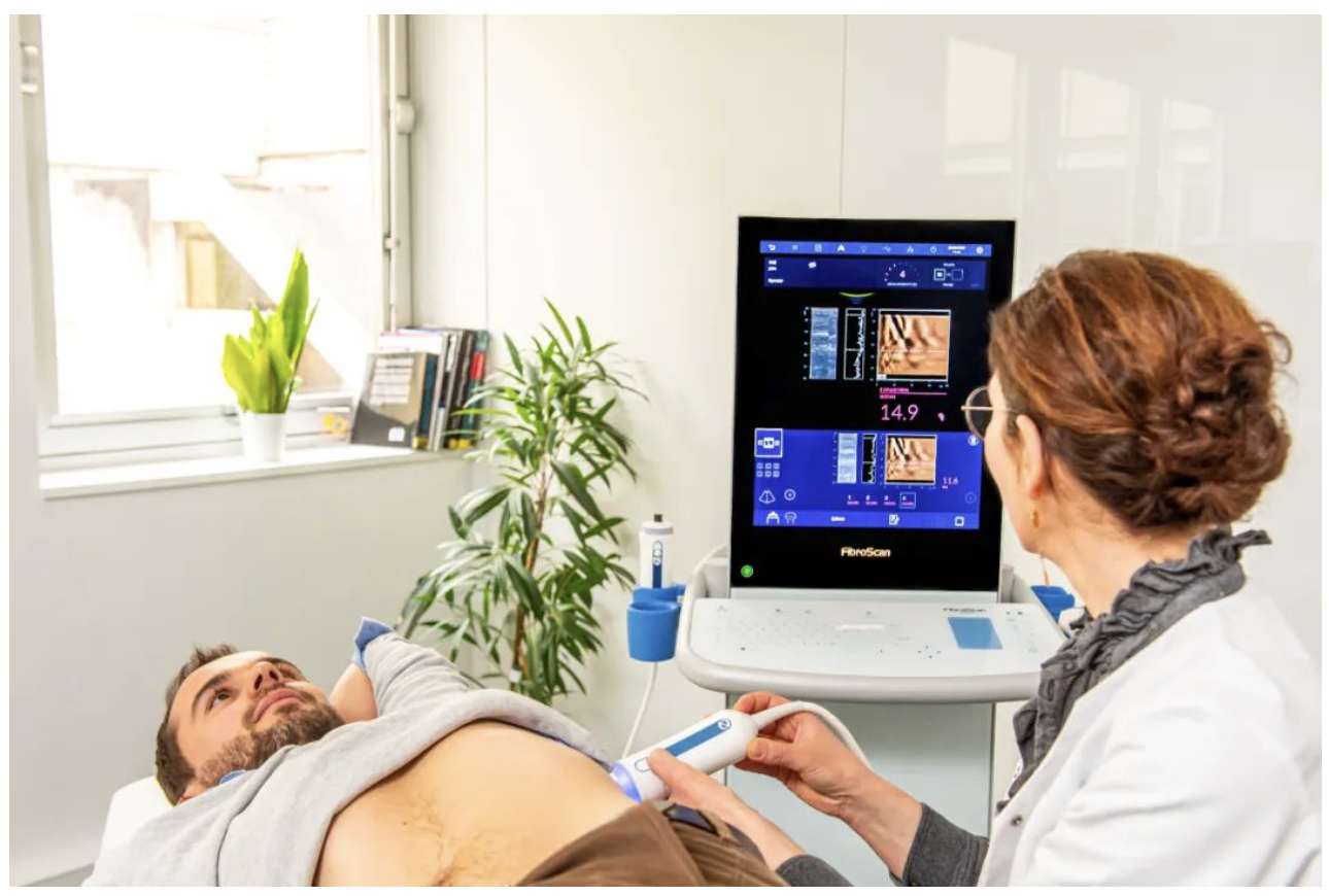 愛科森?學(xué)院專欄 | FibroScan?全球指南與共識推薦介紹（門靜脈高壓篇）